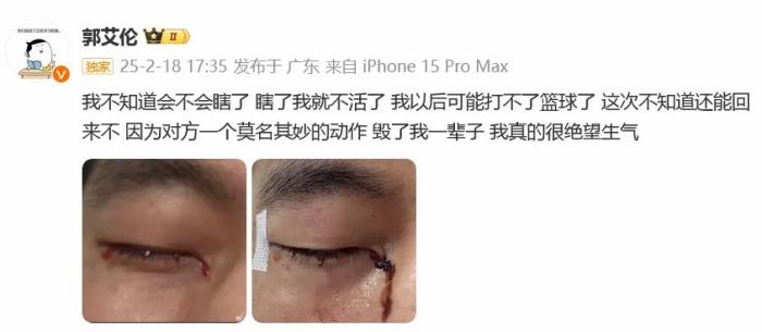 郭艾伦右眼缝合40针发声：被队友刺伤后遭冷漠对